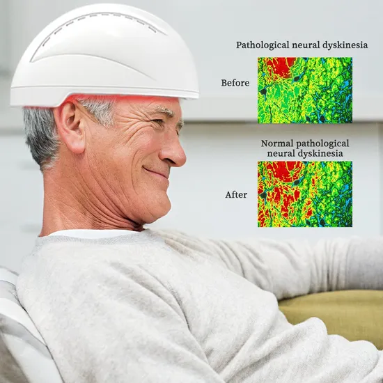 Machine de thérapie par lumière infrarouge pour casque de neurostimulation Suyzeko pour la thérapie par photobiomodulation